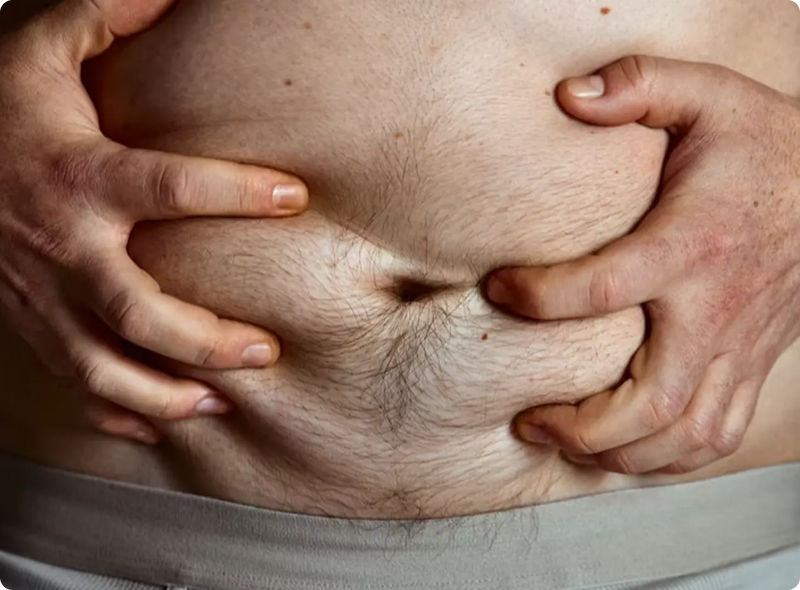 Your Bloating  May Not Be About What You Ate